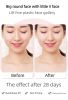 New ultrasonic peeling machine multifunctional facial blackhead peeling instrument- Hard Rock Health